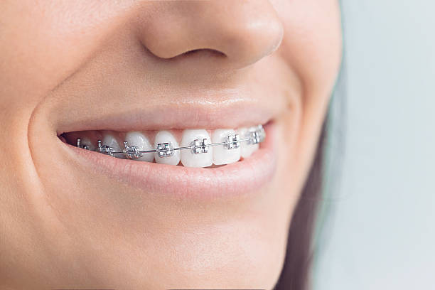 Why Choose Us for Your Dental Needs in Rodeo, CA